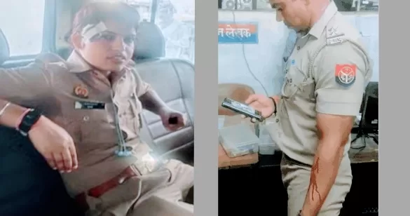 Agra News: महिला की शिकायत पर पहुंची पुलिस टीम पर दबंगो का हमला, थाना प्रभारी सहित महिला पुलिसकर्मी घायल, तीन हिरासत में